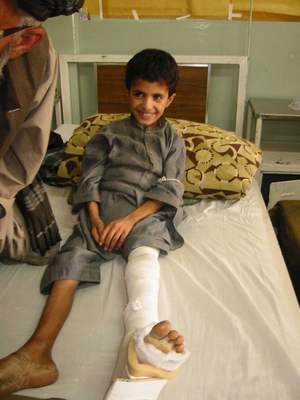 足に包帯を巻いたベッドの少年の写真